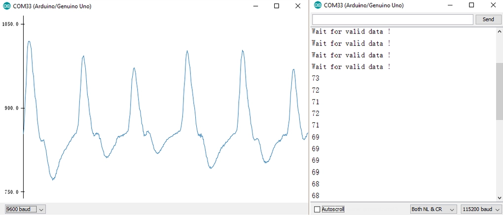 Cảm biến nhịp tim là gì Tổng quan và nguyên lý hoạt động 2 Biểu đồ tín hiệu nhịp tim từ cảm biến PPG